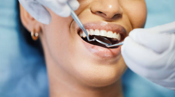Best Emergency Dental Care for Broken or Chipped Teeth in Guthrie Center, IA