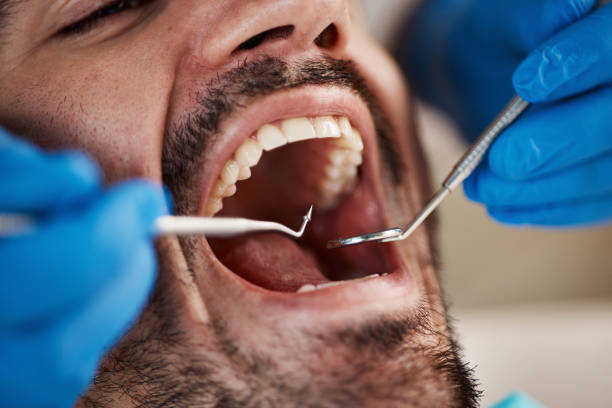Best Same-Day Emergency Dental Services in Guthrie Center, IA