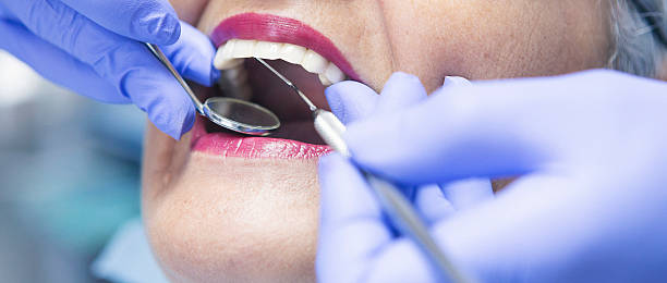 Best Emergency Treatment for Dental Infections or Abscesses in Guthrie Center, IA